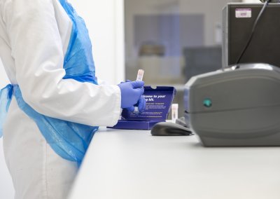 Allergy Blood testing labs